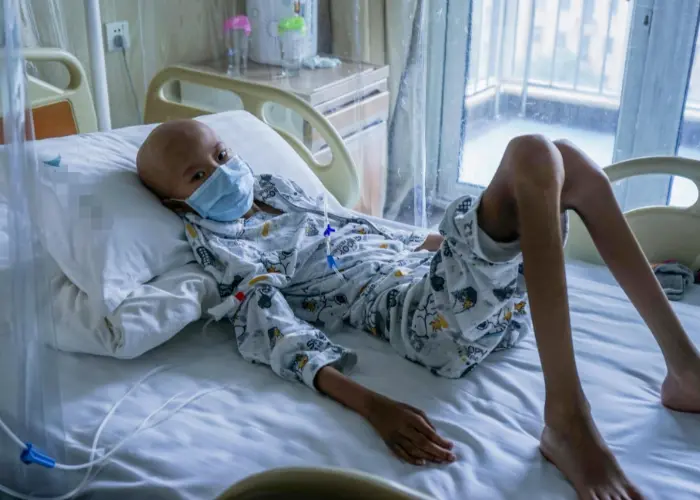 白血病人能喝化橘红吗？化橘红的功效与作用是什么？  2